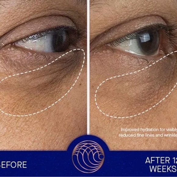 Augustinus Bader | The Eye Cream | MSRP $40 | Travel Size | 3ml | New in Box - Picture 2 of 2